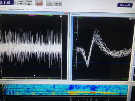 סיכומי ההרצאות בכנס מעבדות OCD - שנת 2026 2